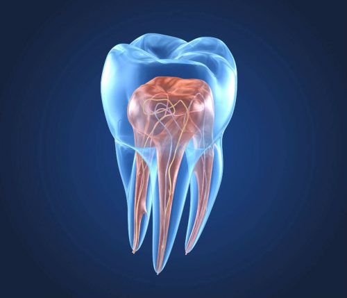 endodontics by emergency dentist Hazel Park MI